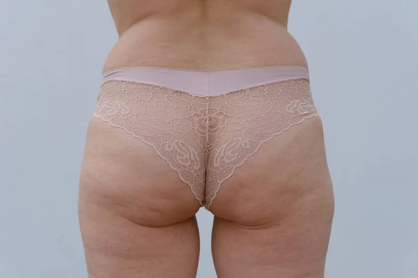 Acercamiento Las Nalgas Una Mujer Mayor Ligeramente Obesa Que Usa — Foto de Stock