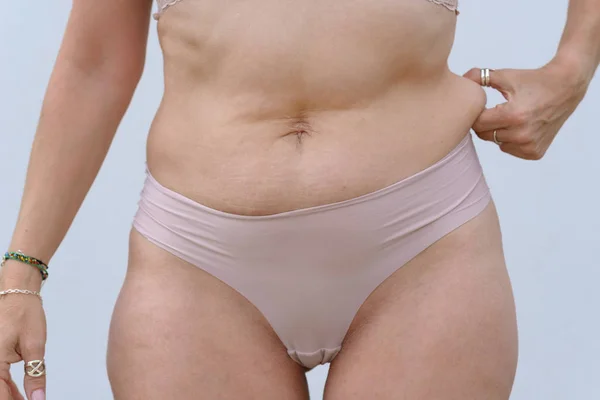 Pulchna Kobieta Trzymania Roll Tłuszczu Wokół Talii Jej Palce Bliska — Zdjęcie stockowe