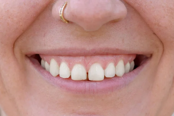 Close Estúdio Tiro Dos Dentes Uma Mulher Meia Idade Feliz — Fotografia de Stock