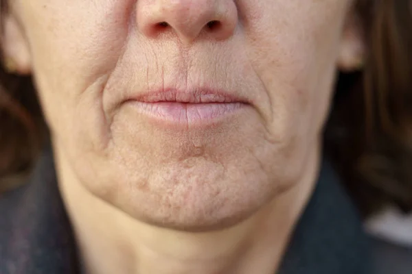 Close-up detail van de kin van een vrouw van middelbare leeftijd — Stockfoto