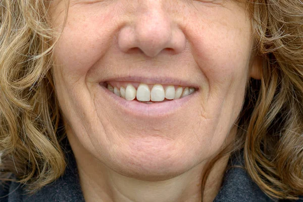 Close up on the smiling mouth of a mature woman — Stock Photo, Image