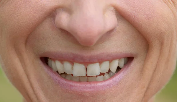 Boca sonriente de una mujer de mediana edad — Foto de Stock