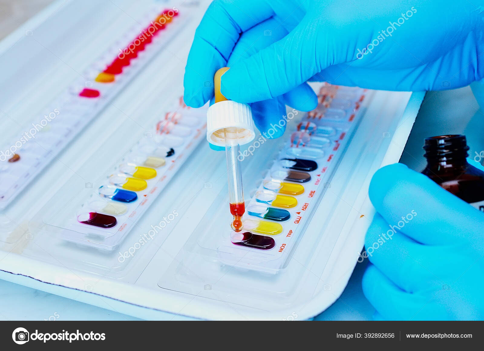 Microbiological Laboratory Mold Fungal Cultures Bacterial Research