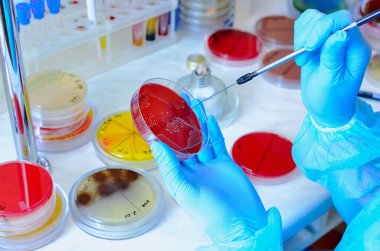 Petri kabı. Mikrobiyoloji laboratuvarı. Küf ve mantar kültürleri. Bakteriyel araştırma