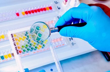 Petri kabı. Mikrobiyoloji laboratuvarı. Küf ve mantar kültürleri. Bakteriyel araştırma