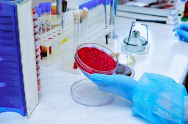 Petri kabı. Mikrobiyoloji laboratuvarı. Küf ve mantar kültürleri. Bakteriyel araştırma