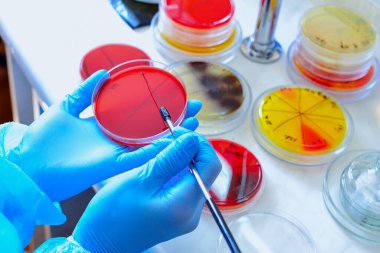 Petri kabı. Mikrobiyoloji laboratuvarı. Küf ve mantar kültürleri. Bakteriyel araştırma