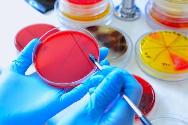 Petri kabı. Mikrobiyoloji laboratuvarı. Küf ve mantar kültürleri. Bakteriyel araştırma