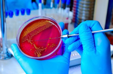 Petri kabı. Mikrobiyoloji laboratuvarı. Küf ve mantar kültürleri. Bakteriyel araştırma