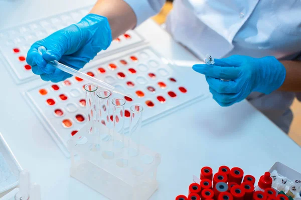 Laboruntersuchung Der Blutgruppe Bluttest — Stockfoto