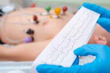 Bir doktorun ellerinde kalp kardiyogramı. Kardiyolog bir elektrokardiyografın tanıklığını inceliyor..