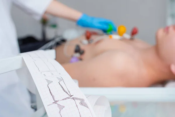 Kardiyogram kağıt bandı kardiyolog 'un ofisindeki yalancı bir hastanın arka planına yakın plan. Kalp kardiyogramı