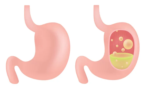 Stomaco Nel Corpo Umano — Vettoriale Stock