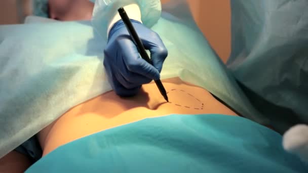 Больница, хирургическое отделение, врачи и медсестры делают операцию — стоковое видео