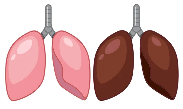 Ilustracja Płuc Człowieka — Wektor stockowy