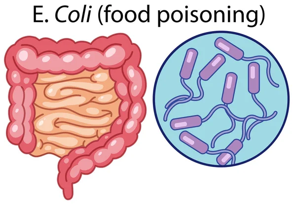 Een Illustratie Vector Van Coli Bacteriën — Stockvector