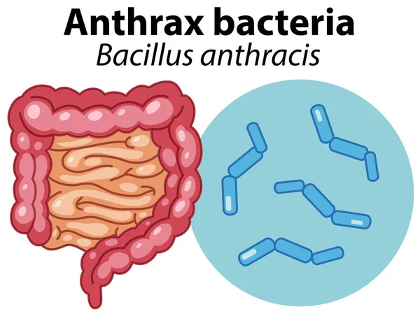 Células Ampliadas Ilustração Bactérias Anthrax —  Vetores de Stock