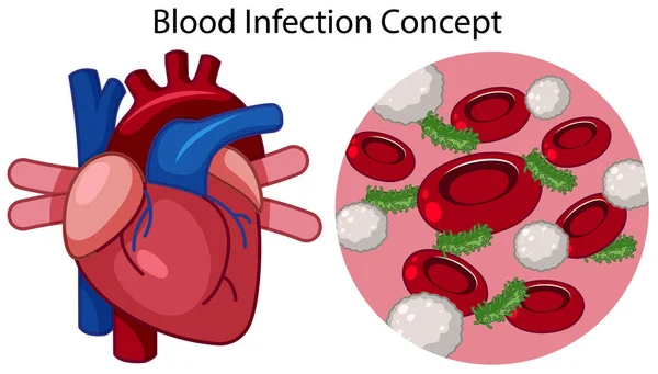 Vector Del Concepto Infección Sangre Ilustración — Archivo Imágenes Vectoriales