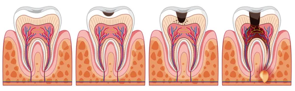 人間の歯のセット図 — ストックベクタ