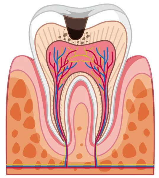 白背景イラストを歯の解剖 — ストックベクタ