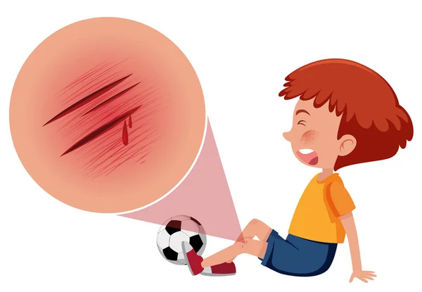 Junge Beim Fußballspielen Verletzt — Stockvektor