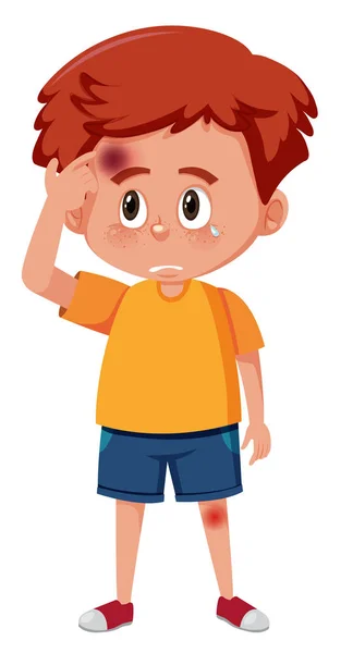 A boy having bruise on head — Stock Vector