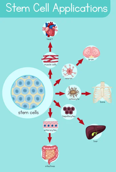 Informative Poster Stem Cell Applications Illustration — Stock Vector