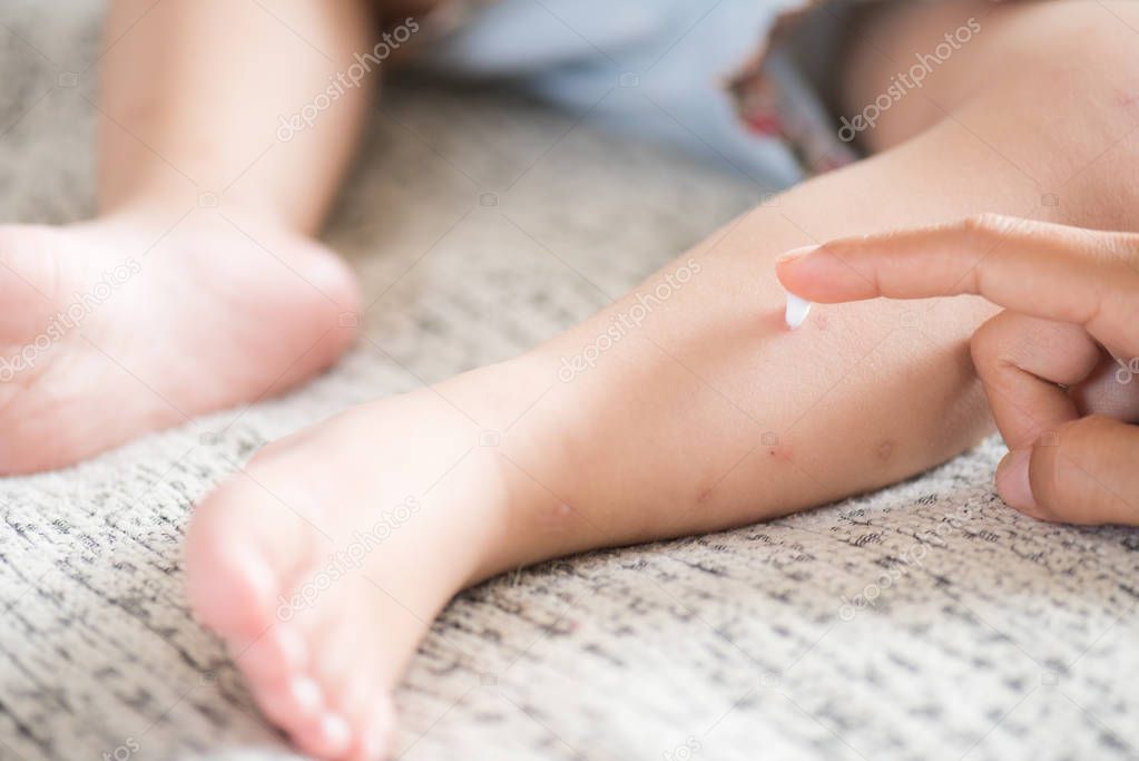Mother applying cream on a girl's legs with red spot, blister. Medicine and health care concept.