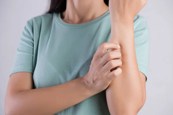 Cierre el brazo de la mujer rascarse la picazón a mano en casa. Salud y concepto médico . — Foto de Stock