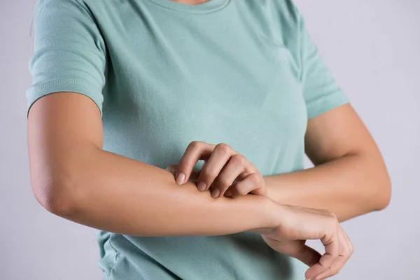 Cierre el brazo de la mujer rascarse la picazón a mano en casa. Salud y concepto médico . — Foto de Stock