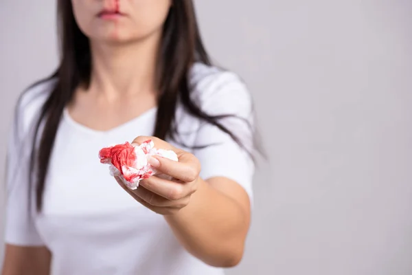 Nosebleed , a young woman suffering from nose bleeding and using tissue paper for stop bleeding. Healthcare and medical concept.