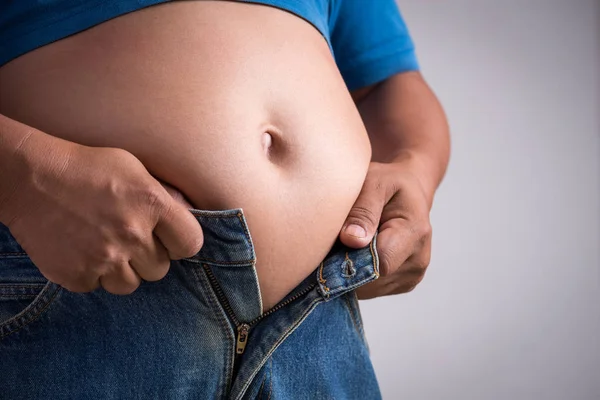 Överviktig eller fet vuxen man i mycket snäva jeans på en grå bakgrund. Hälso- och sjukvård, medicinska begrepp. — Stockfoto