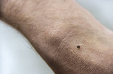 bir kişi kolundaki vücudunda kırmızı kene kene tarar