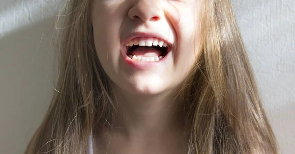 Sobre fondo blanco chica sonriente blanco nieve sonrisa dientes sanos — Foto de Stock