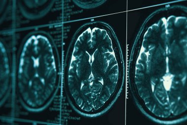 MRI ya da manyetik rezonans görüntüsü baş ve beyin taraması. Görünümü kapatın
