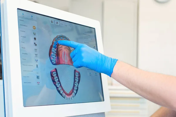 Dentysta narzędzie zębów u pacjentów z skaner 3d. — Zdjęcie stockowe
