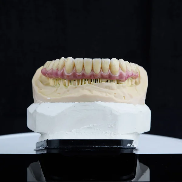 Technik dentystyczny pracujący z artykulatorem w laboratorium stomatologicznym — Zdjęcie stockowe