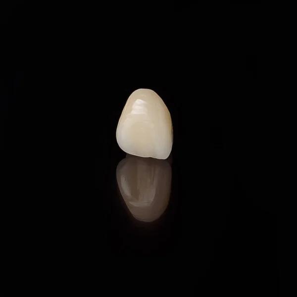 Високоякісна зубна коронка на чорному тлі, крупним планом морфологія зубів . — стокове фото