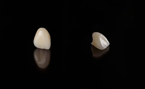 Високоякісні керамічні зубні коронки на чорному тлі, морфологія зубів . — стокове фото