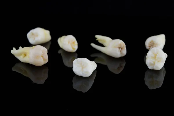 Dientes humanos rotos sobre un fondo negro. Foto de cerca de molares y premolares estropeados. Enfoque selectivo. —  Fotos de Stock