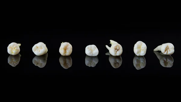 Зуби людини укладаються поспіль на чорному тлі. Крупним планом фото зіпсованих молярів і премолярів . — стокове фото