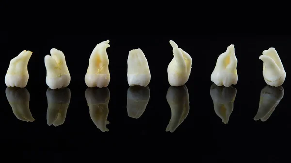 Видалені хворі зуби людини укладаються поспіль на чорному тлі. Крупним планом фото зіпсованих молярів і премолярів . — стокове фото
