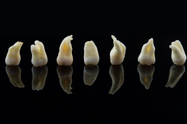 Yedi tane hastalıklı insan dişi siyah arka planda üst üste yığılmış. Bozuk azı dişlerinin ve azı dişlerinin yakın plan fotoğrafı..