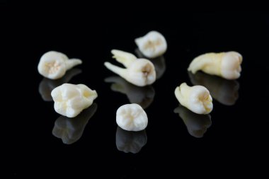 Siyah arka planda insan dişleri yırtılmış. Şımarık azı dişlerinin ve azı dişlerinin yakın plan fotoğrafı. Seçici odak.