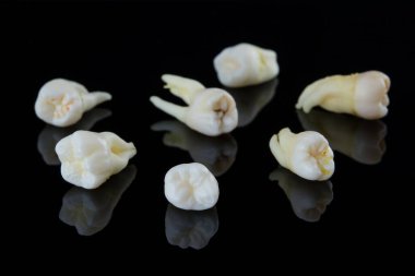 Siyah arka planda insan dişleri yırtılmış. Şımarık azı dişlerinin ve azı dişlerinin yakın plan fotoğrafı. Seçici odak.