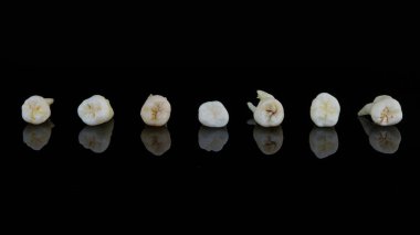 Siyah arka planda üst üste dizilmiş yırtık insan dişleri. Bozuk azı dişlerinin ve azı dişlerinin yakın plan fotoğrafı..