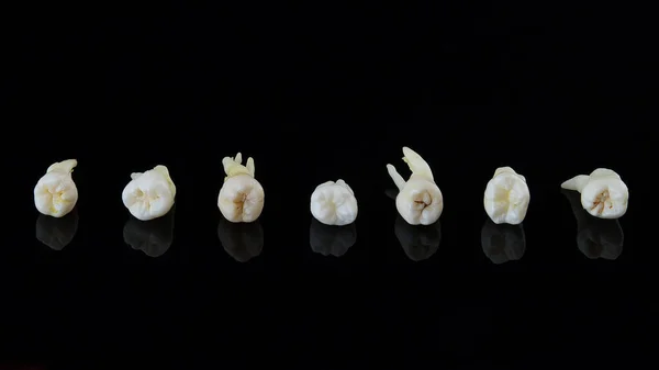 Зуби людини укладаються поспіль на чорному тлі. Крупним планом фото зіпсованих молярів і премолярів . — стокове фото
