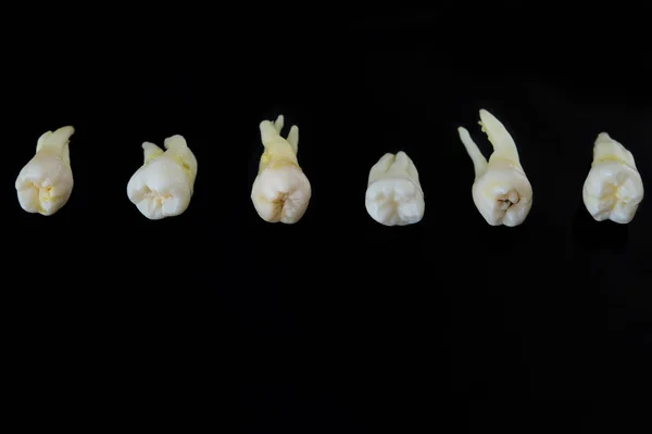 Тьмяні хворі зуби людини укладаються в ряд ізольовані на чорному тлі. Крупним планом фото зіпсованих молярів і премолярів . — стокове фото