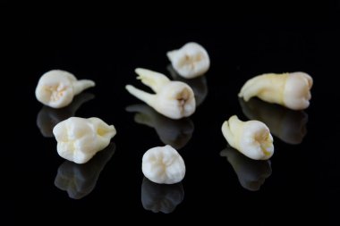 Siyah arka planda insan dişleri yırtılmış. Şımarık azı dişlerinin ve azı dişlerinin yakın plan fotoğrafı. Seçici odak.