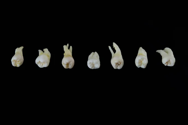 Тьмяні хворі зуби людини укладаються в ряд ізольовані на чорному тлі. Крупним планом фото зіпсованих молярів і премолярів . — стокове фото